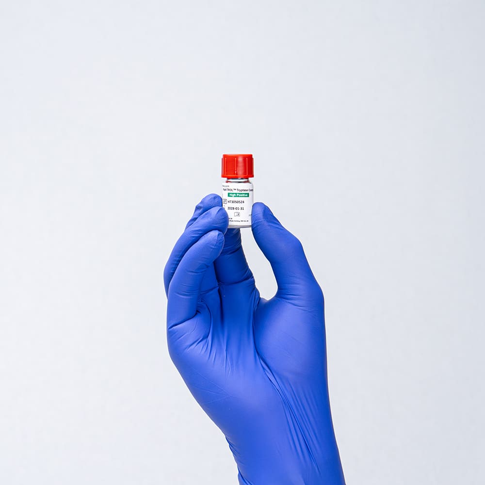 PathTROL™ Tryptase High Positive Control – Image 2