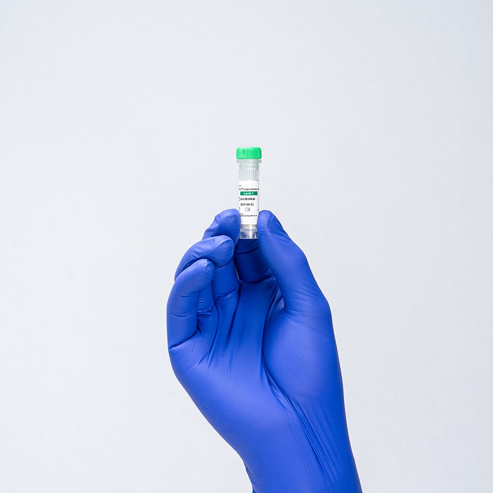 PathTROL Calprotectin Control A Level 1 molecular diagnostic control kit