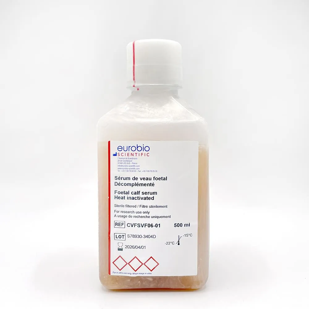Heat-Inactivated Fetal calf Serum