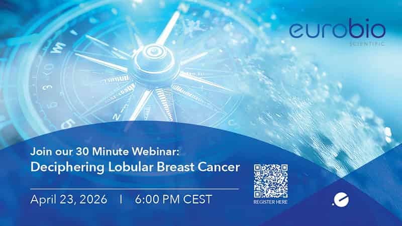 Deciphering Lobular Breast Cancer